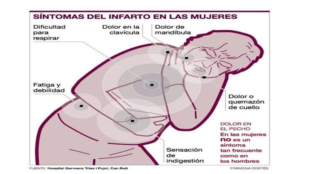 Síntomas Infarto Mujer Fundación Hipercolesterolemia Familiar 4589